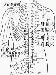 阿祖苗药养生膏药穴位贴敷图片