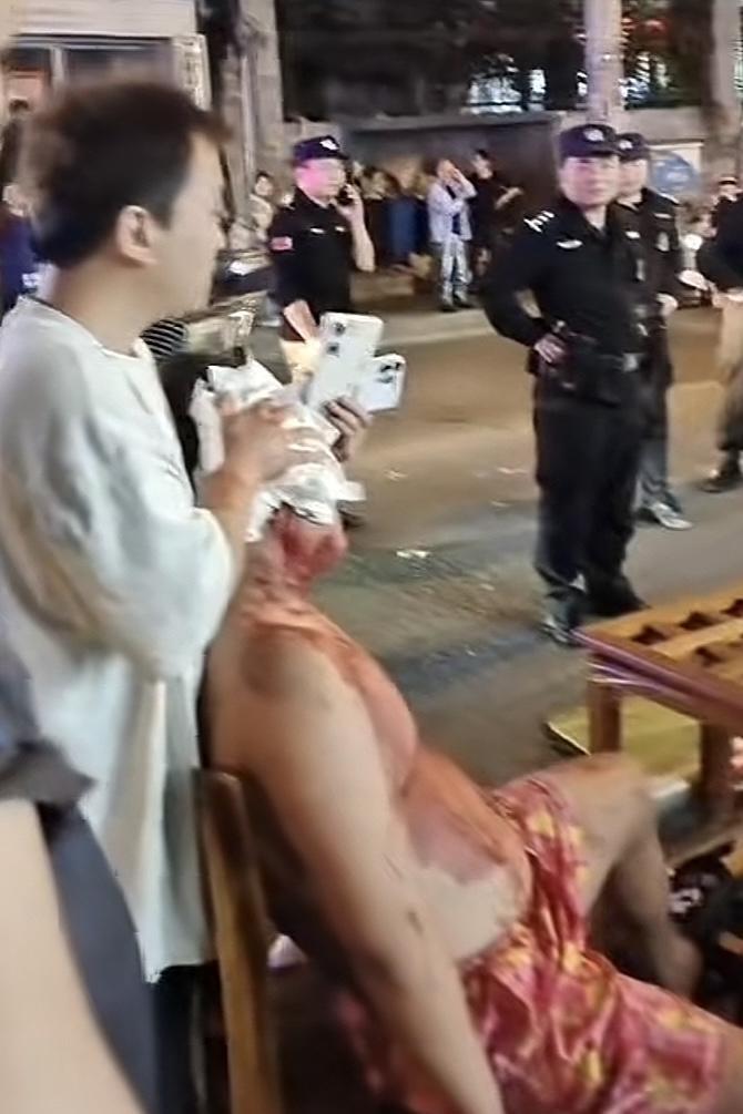 酒前谈笑风生，酒后真刀真枪。好兄弟喝个酒打得全身都是血，脑门都打破了，捂都捂不住