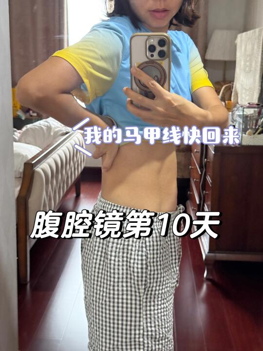 腹腔镜术后第10天｜🏃‍♀️我要去跑步
