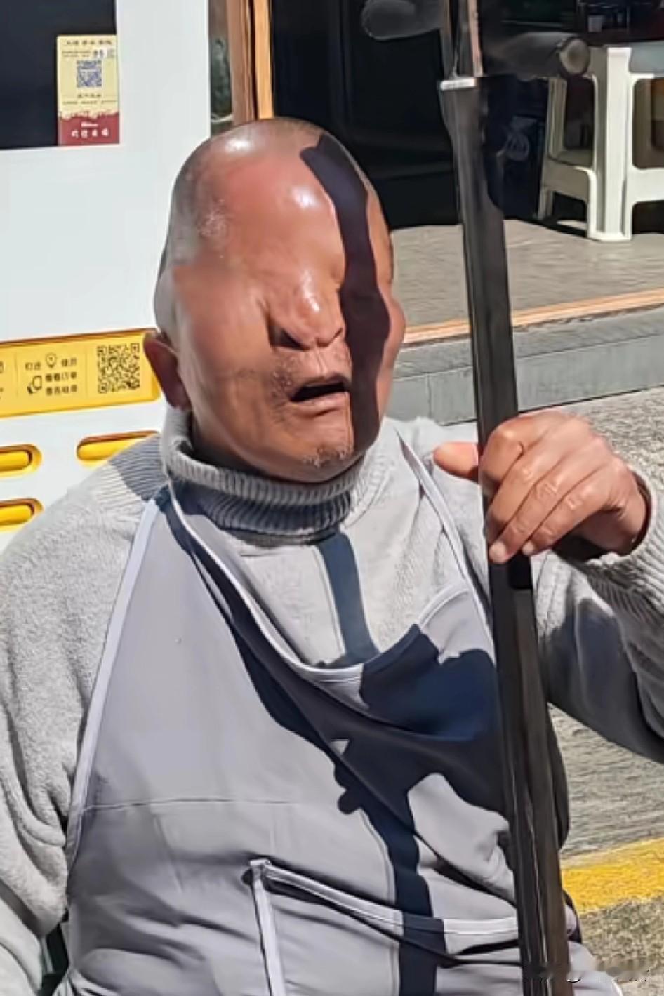 来了大理古城看见一位比悲惨更悲惨的人，生来没长眼睛，就连痛哭时眼泪都没有地方流出