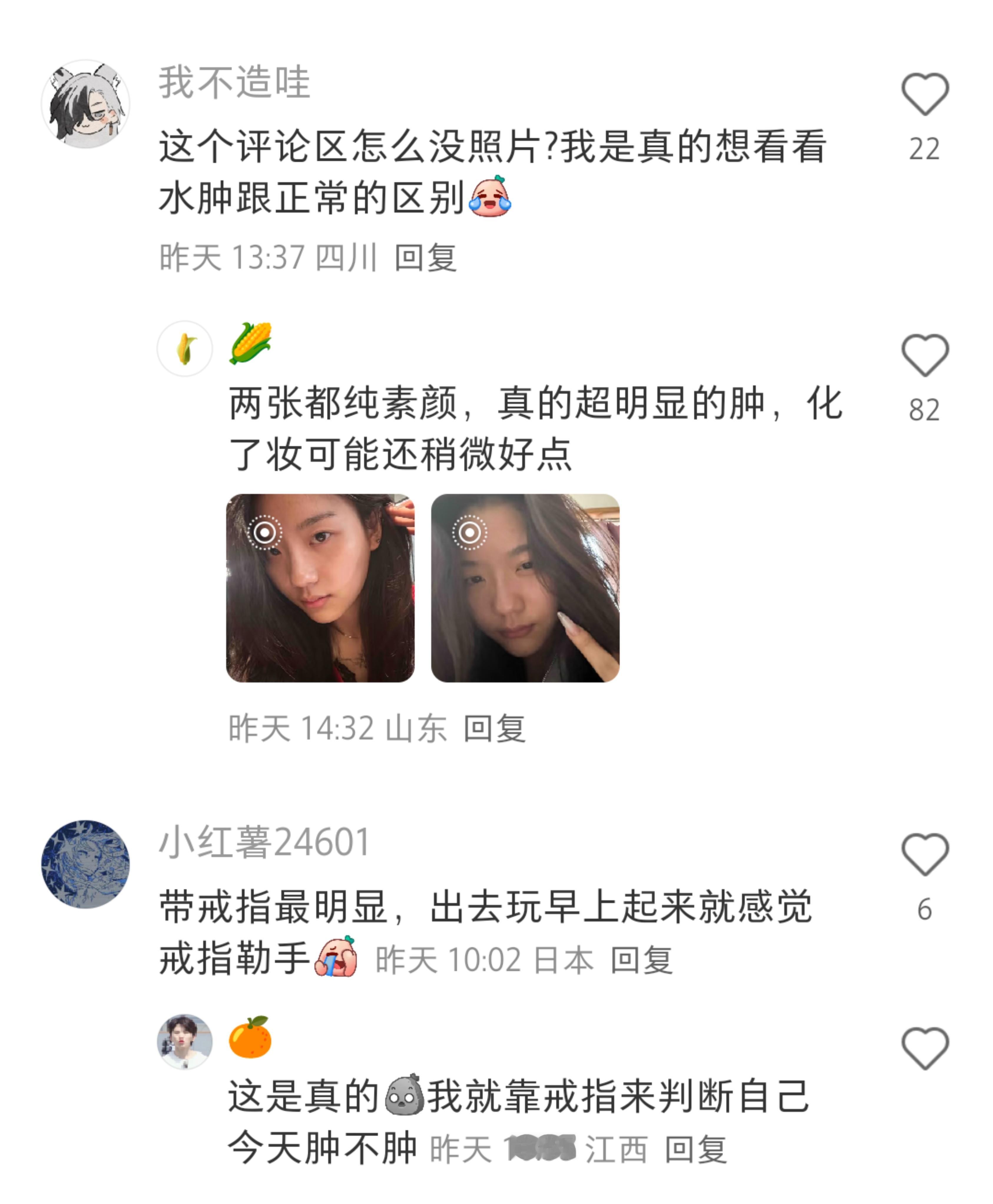 原来这样不是胖了而是水肿了。。。