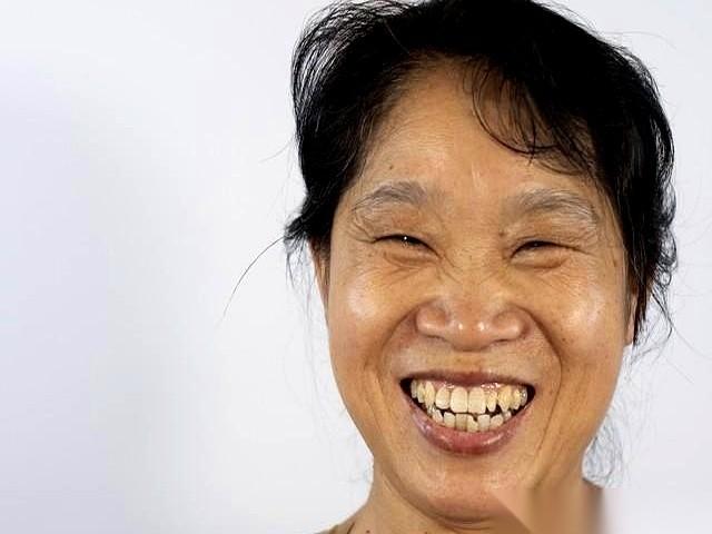 60岁了，牙齿一颗没掉，先别忙着高兴。在很多人的常识里，牙口好就等于寿命长，但