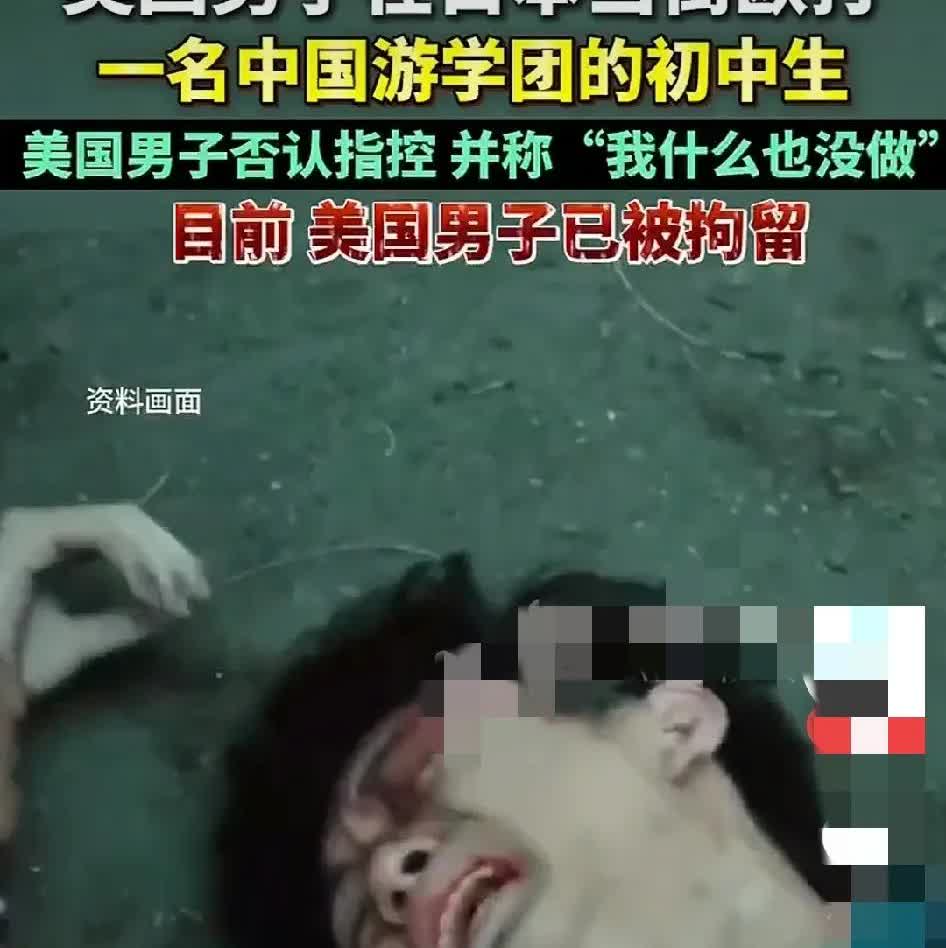 美国鬼子素质太低，抗美援朝的时候没打疼他们，让他们自我优越感强，应该给他们按摩个