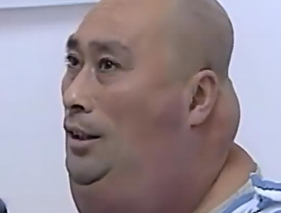 这也太吓人了，医生看了都直摇头，2013年末，东北的李秋武裹得密不透风，跑到沈阳