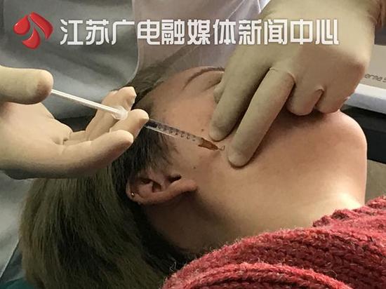当心这种肉毒素! 有人打针脸烂了