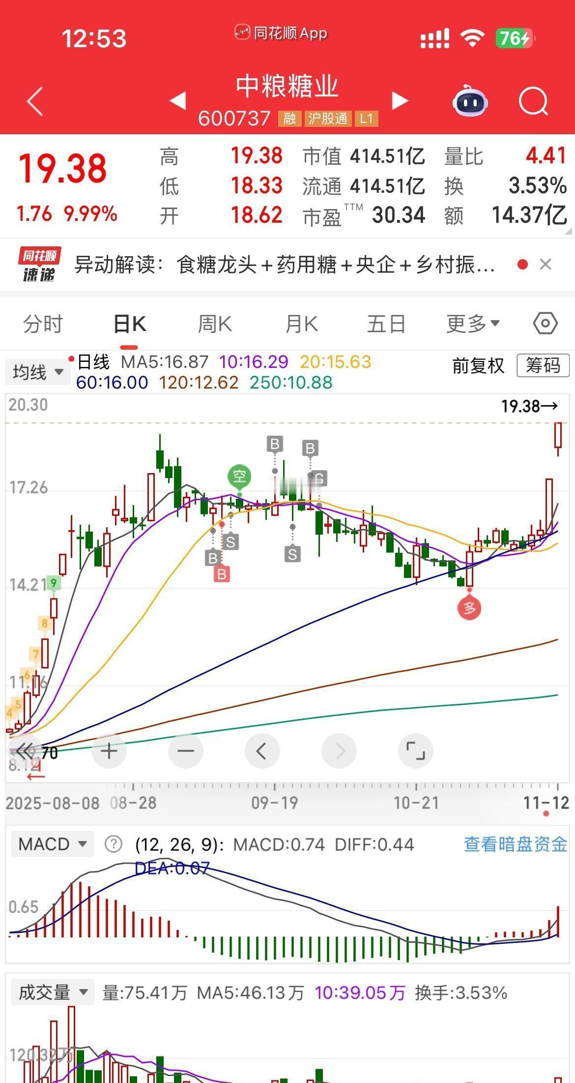 炒股：机会总是眨一下眼就溜走炒股的世界能让人体会最深刻的反复无常——机会总是