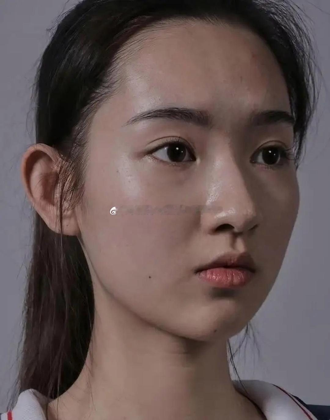 28岁王玉雯生图曝光，脸上有很多痣，不化妆和普通人没什么区别。