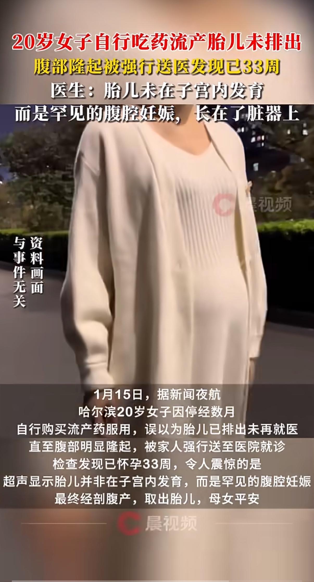 20岁姑娘自己吃药想流产，以为事儿办完了，没想到肚子越鼓越大，最后查出胎儿在腹腔