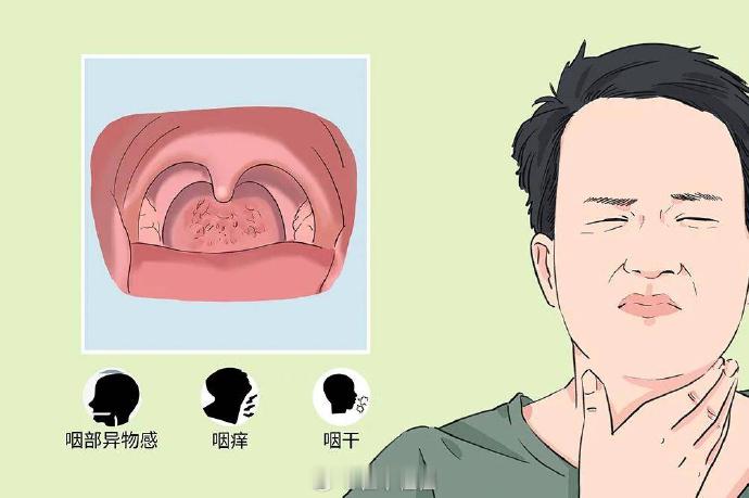 慢性咽炎处理5个穴位，鸠尾穴、中脘穴、神阙穴、丰隆穴、足三里。鸠尾穴和中脘穴在上