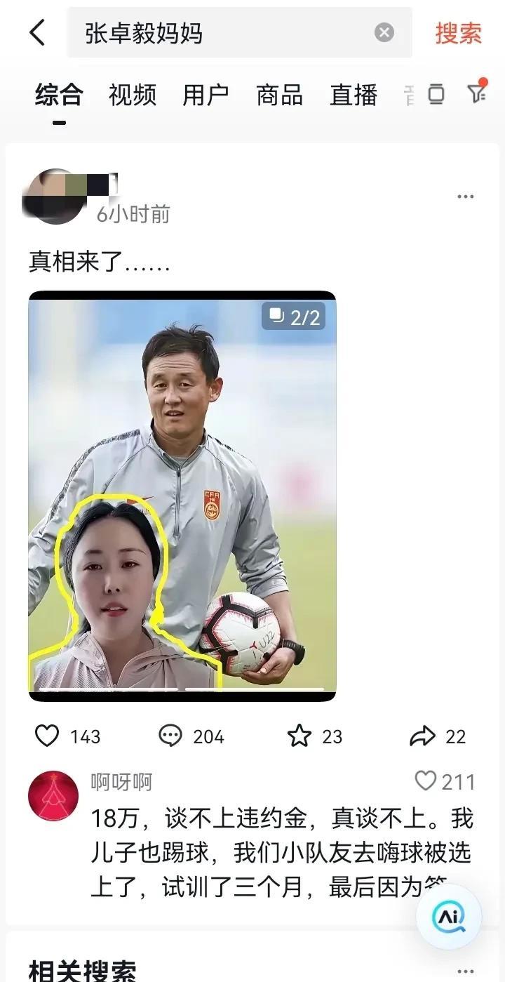 赔偿18万对于一个普通家庭来说，肯定是非常多的！如果孩子不踢足球，1年4个月时