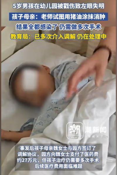 江西瑞昌，幼儿园里，一个孩子将另一个孩子的眼睛给戳了，老师看到孩子疼得哇哇哭，竟