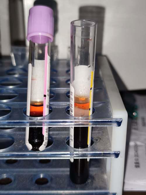 权威机构检测数千例中国人血清样本，74种化学物质被检测到，鲁苏浙沪为重灾区。