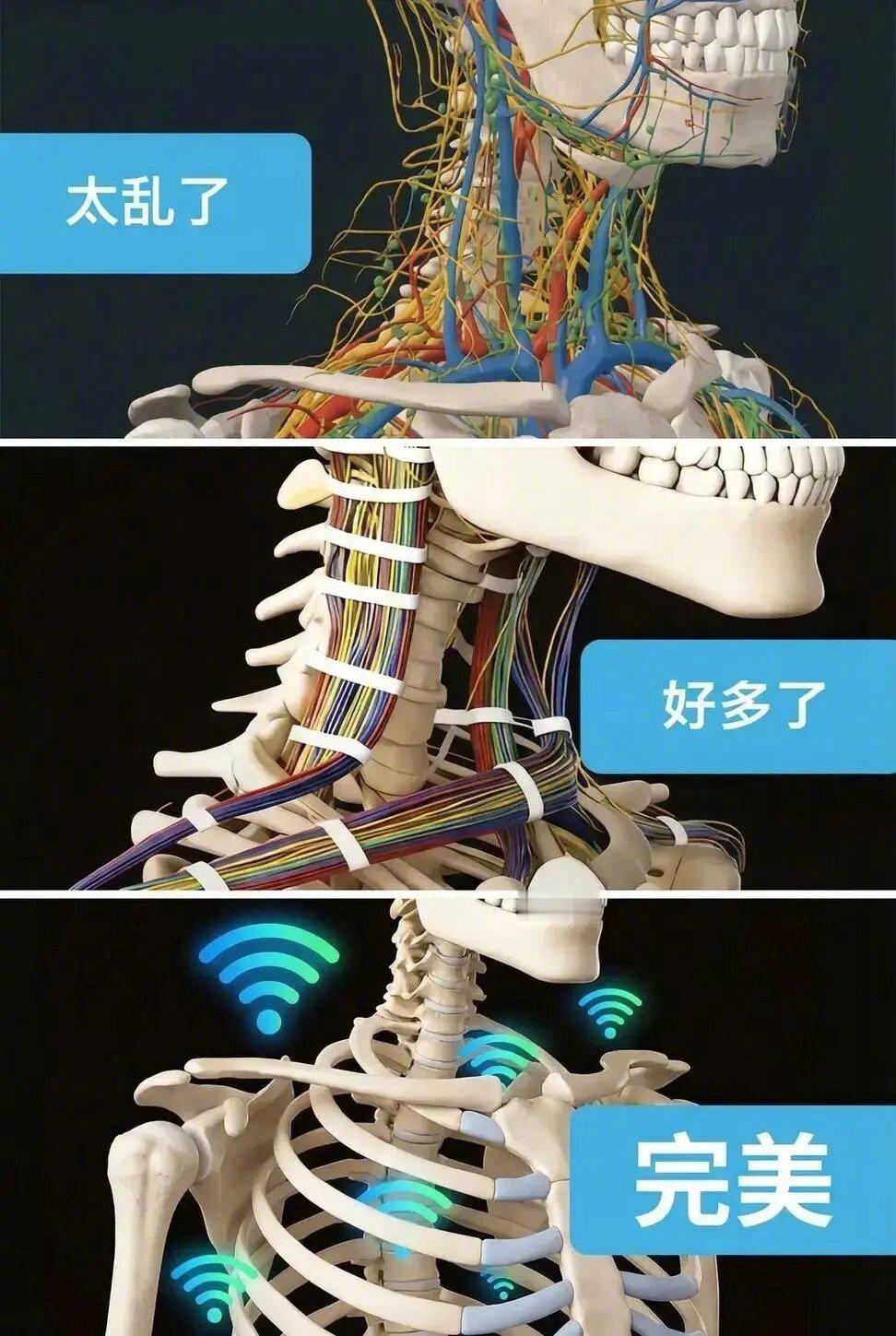 哈哈哈，这个太逗了，最后改无线传输了。