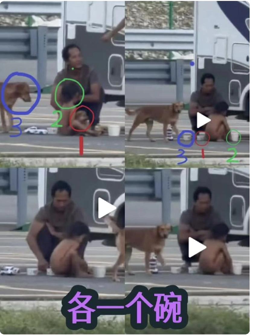 你问我答不懂就问，如果野人小孩现在可以站立，能不能直立行走？脊柱的发育能不能恢复