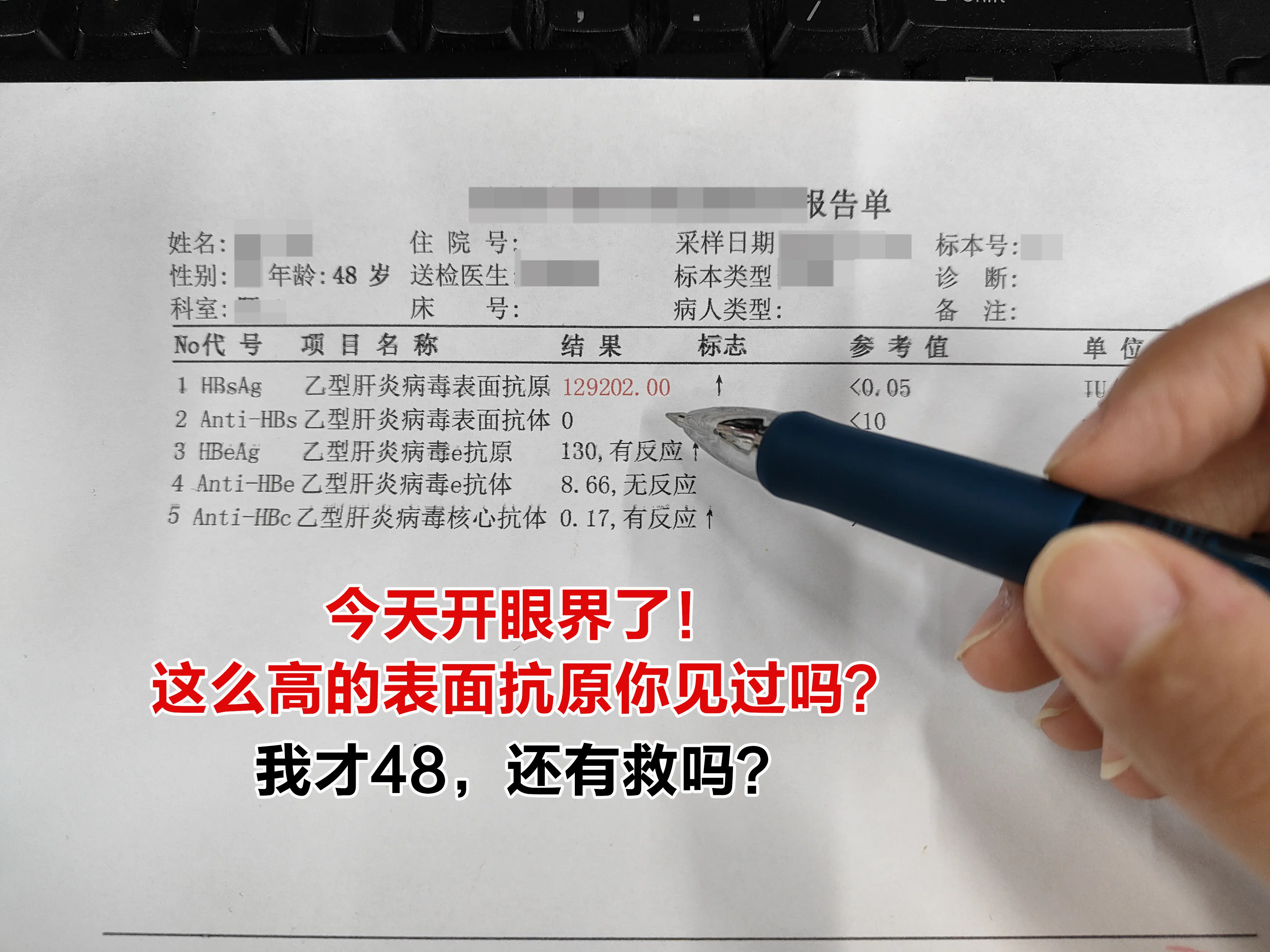 “这位朋友，表面抗原12万多，这个数值在临床确实属于比较高的水平。它其...