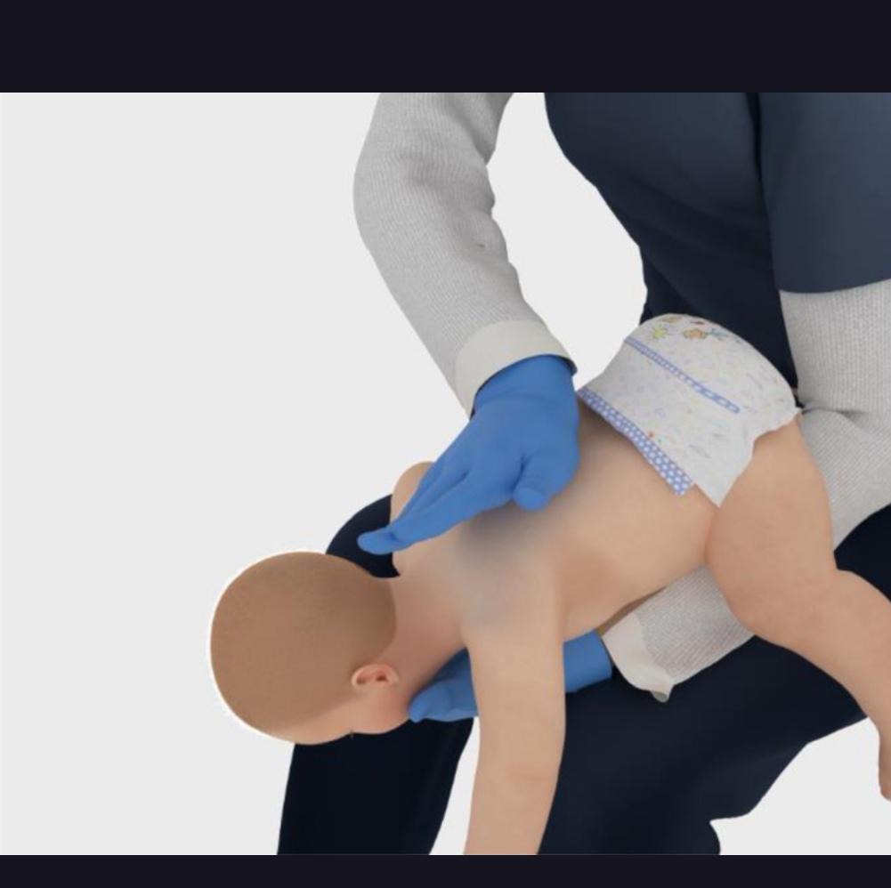 新版海姆立克急救法：科学调整，守护生命在紧急时刻，海姆立克急救法是挽救气道梗