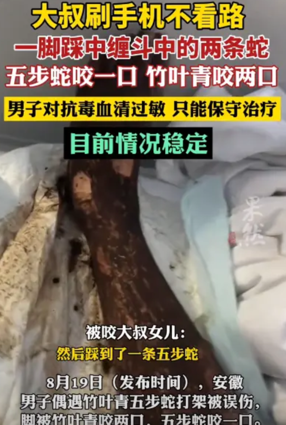 这运气绝了！安徽，大叔傍晚回家，一边走一边玩手机，突然踩到五步蛇，被狠狠咬了一口