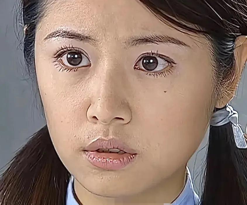 离开滤镜，林心如一脸粉刺黑头，真的算不上漂亮。都被她的如萍给骗了？当初看《情深