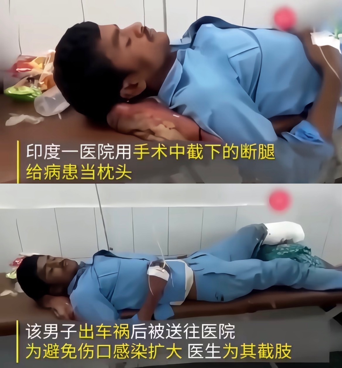 史诗级惨遭