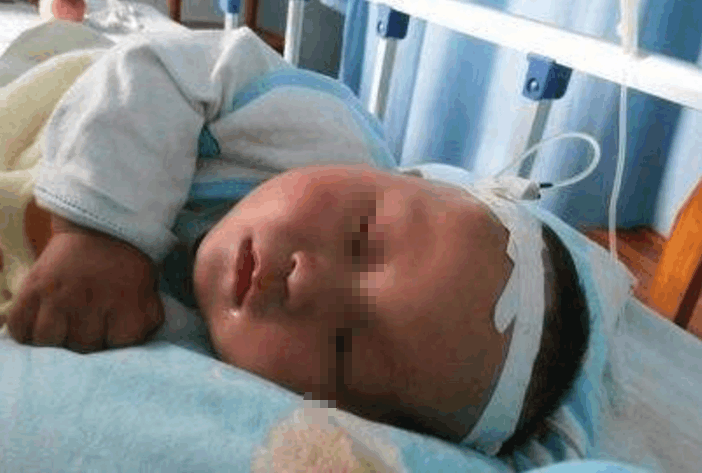 七个月宝宝被查出肾脏负担过重, 因宝妈常给它吃这玩意造成的!
