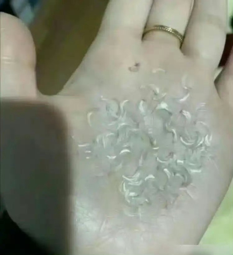 近视手术就是一场醒不来的骗局……