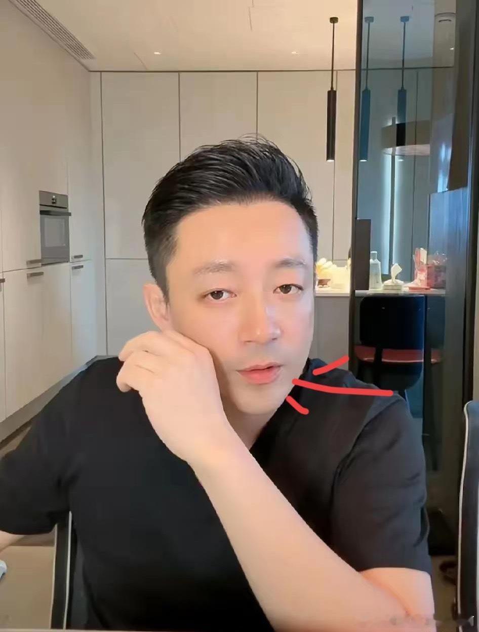 发现了吗，汪小菲真的面相都变了，不信你看昨天的直播中，看到现在的他唇红齿白精神焕