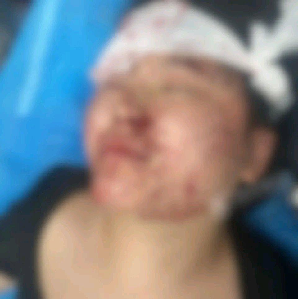 郑州30岁的丁女士真是给大家敲响了警钟。那天晚上下雨，她边骑电车边玩手机，结果一