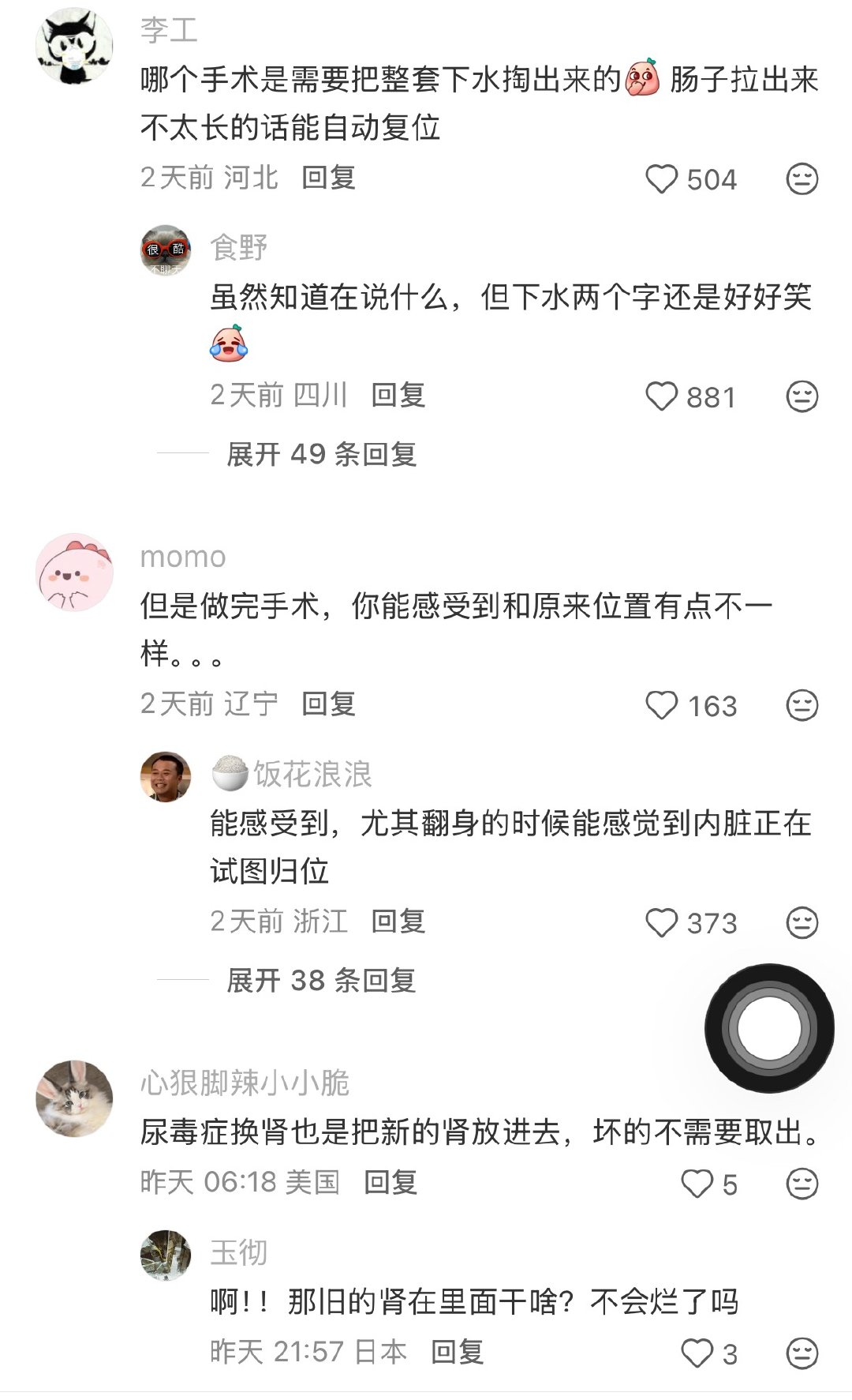 原来人的内脏会找到自己的位置 ​​​