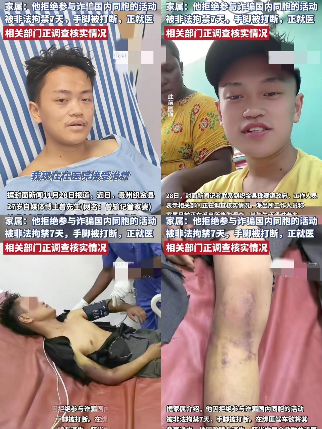 大难不死必有后福！27岁网红曾输坦桑尼亚旅行被绑架，身体遭受虐待，背后操