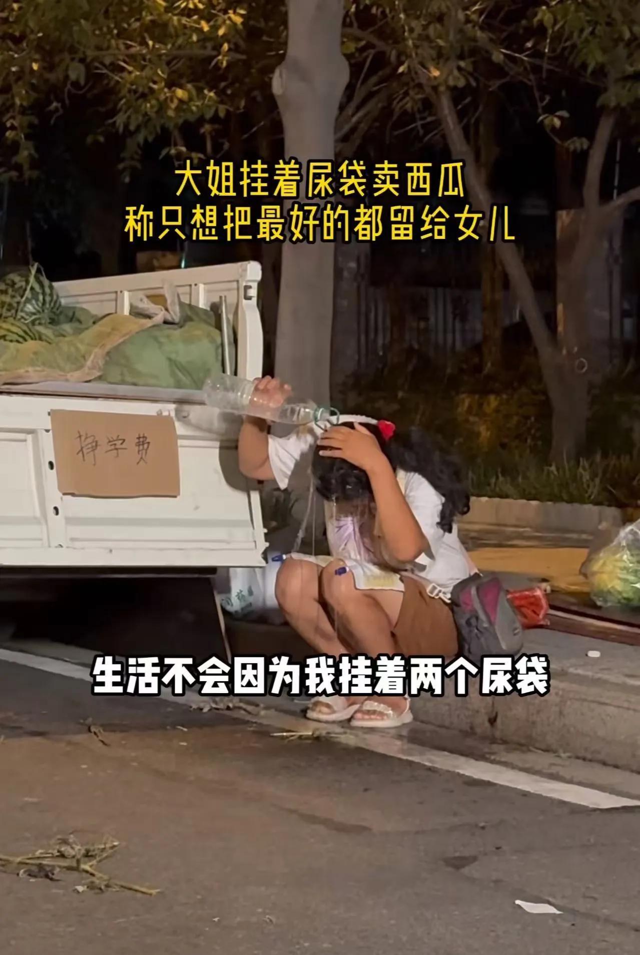 深夜，男子看到一个大姐挂着尿袋卖西瓜，忍不住问她为什么生病还出来摆摊！大姐笑笑说