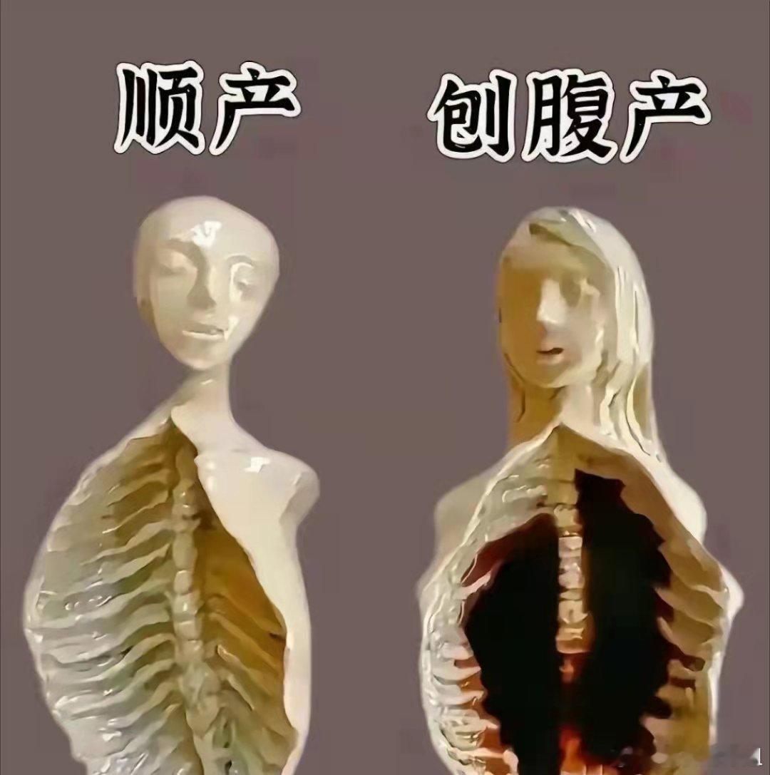 顺产与剖腹产到底哪个好？​​​