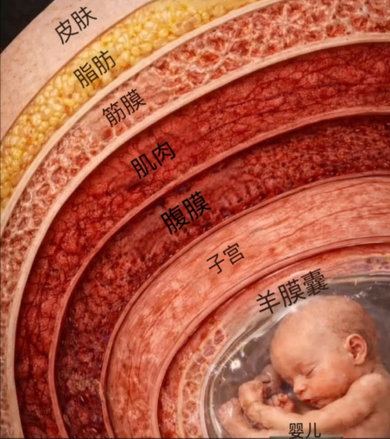 你以为剖宫产只是划一刀？