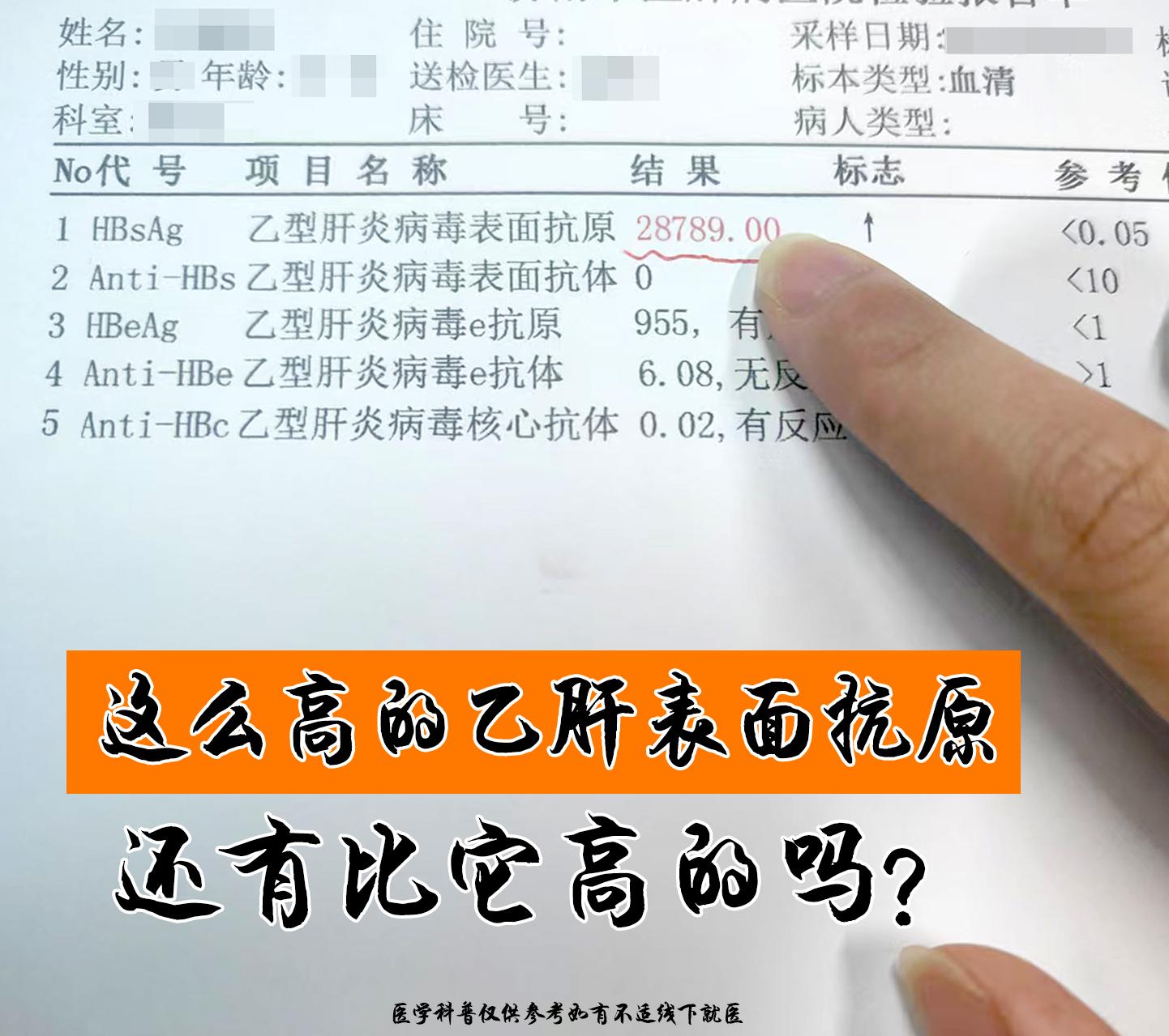 这么高的乙肝表现抗原，还有比它高的吗？  乙肝表面抗原抗原2万多，是不...