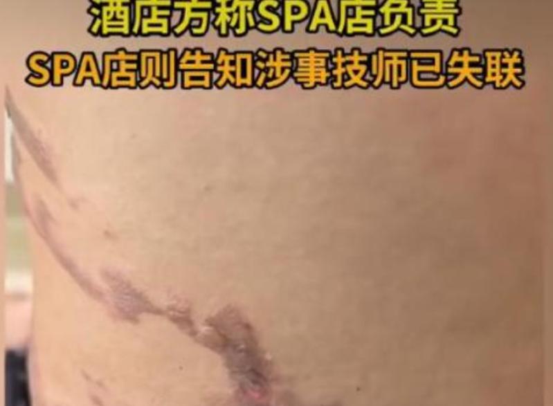 武汉这个事，真把人看气了。一个姑娘，研三了，马上要毕业。7月4号晚上跟朋友住进酒