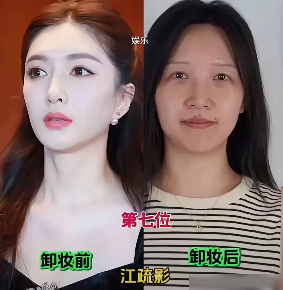 张雨绮关掉滤镜那一刻，评论区直接炸了。这姐们被嘲鼻孔不对称、面部僵硬，反手甩一张纯素颜怼脸照，配文就