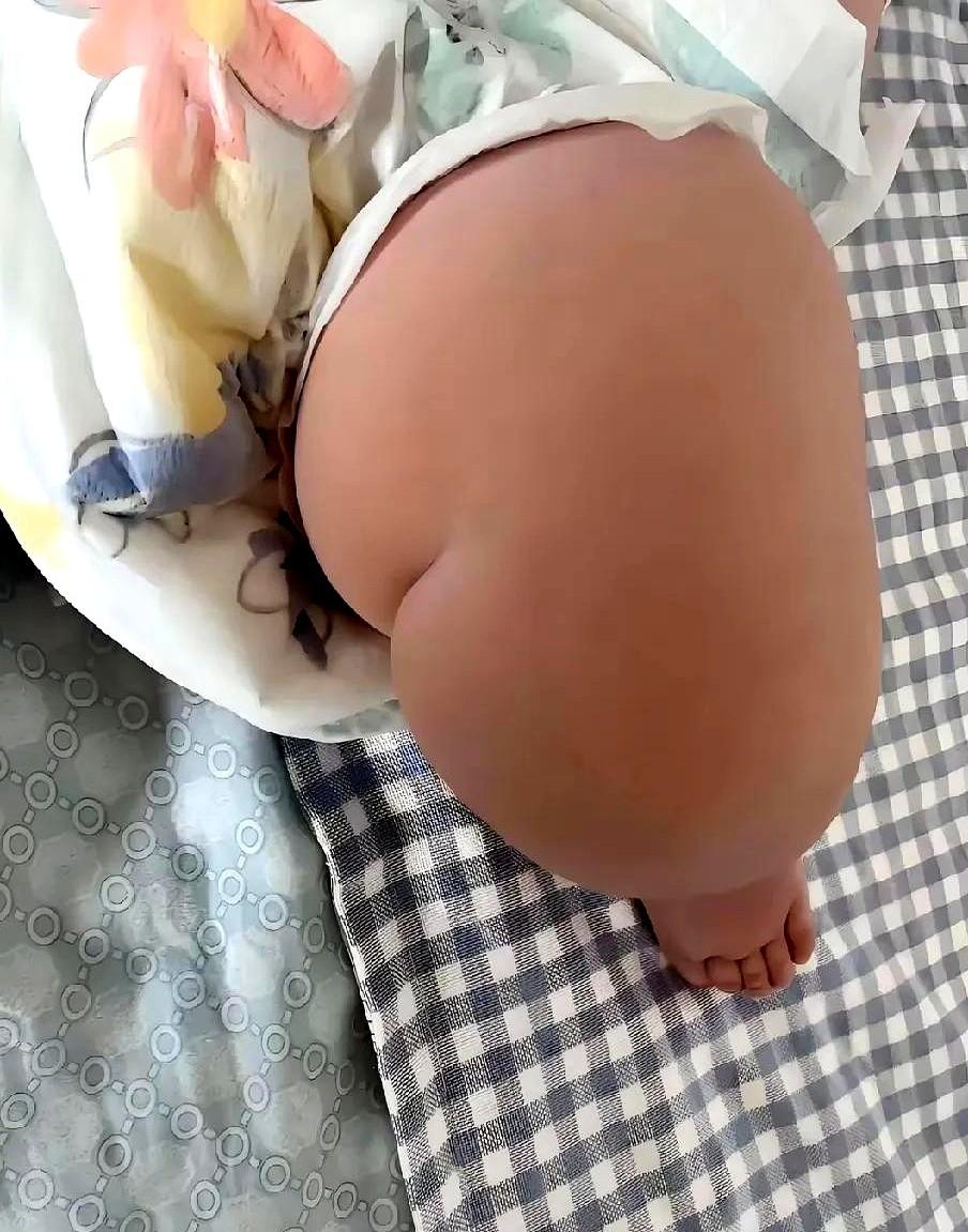 愁死了！我姐家10个月大的孙子，都快20斤了！医生说这体重严重超标，让控