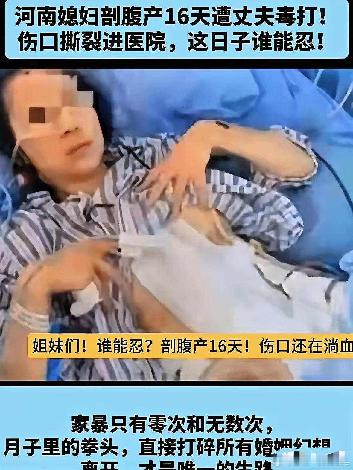河南这事儿看得我后背发凉！11月14日，还在坐月子的产妇，剖宫产才16天，因为孩