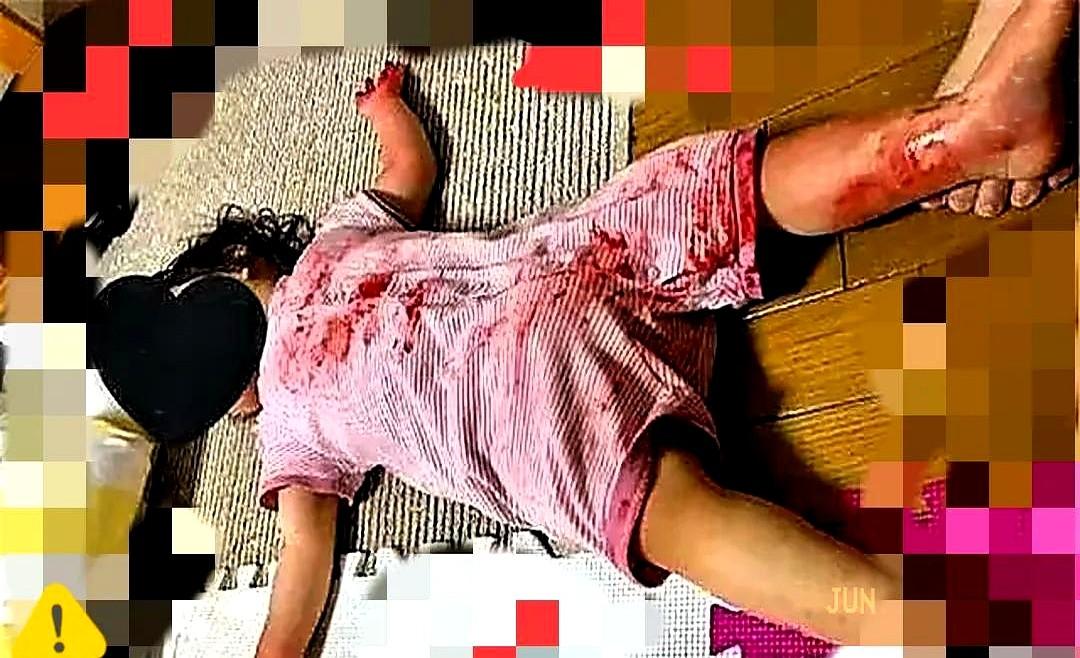 妈妈下楼取快递，让3岁女儿独自在家午睡，回家后，女儿躺在地上一动不动的，身上都是