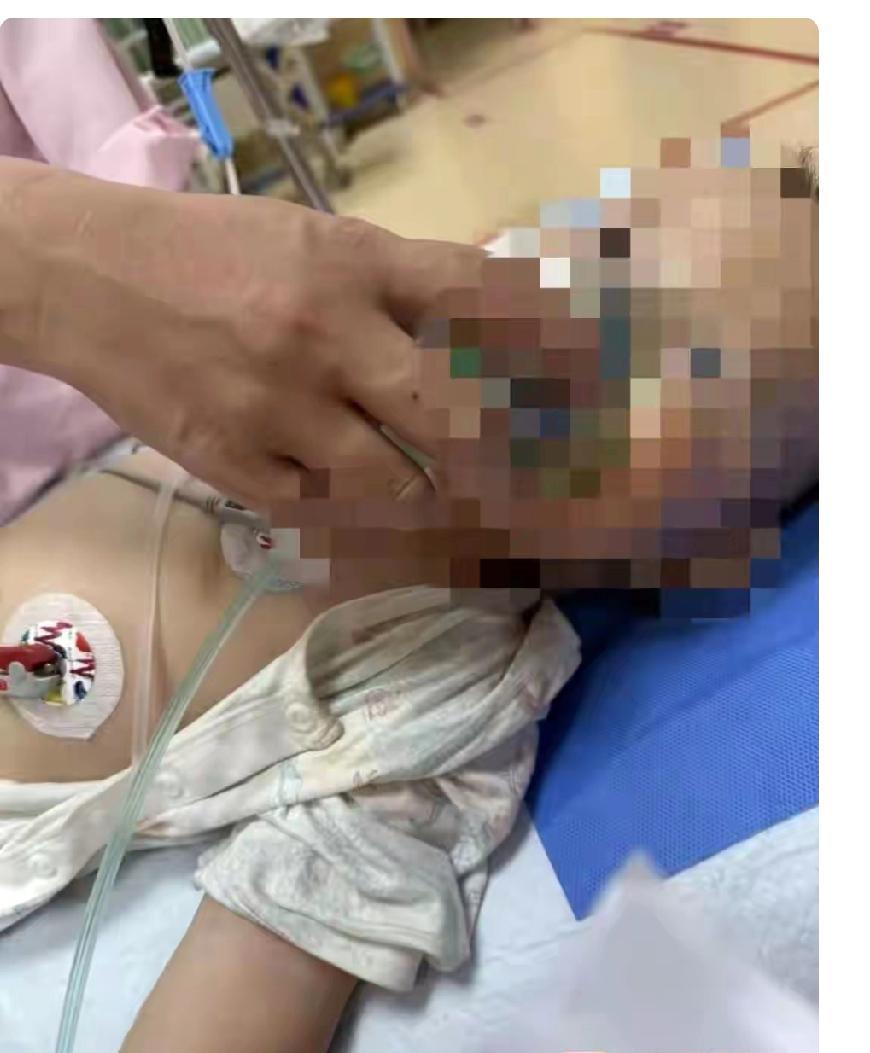 贵州贵阳，一个一岁多的娃娃，半夜突然浑身抽搐、身体僵直、意识全无。送到医院一查，