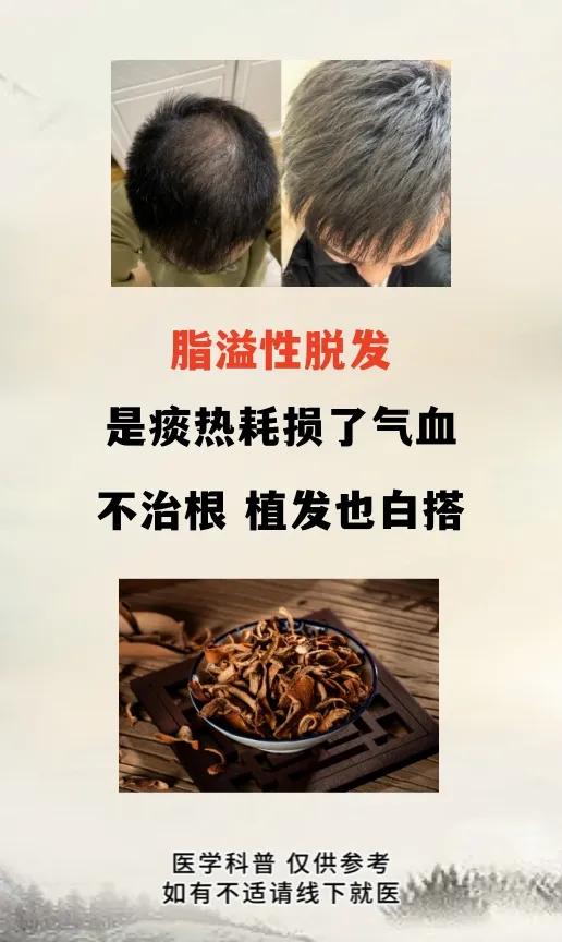 脂溢性脱发是痰热耗损了气血不治根植发也白搭溢脂性脱发在近些年来非常多见