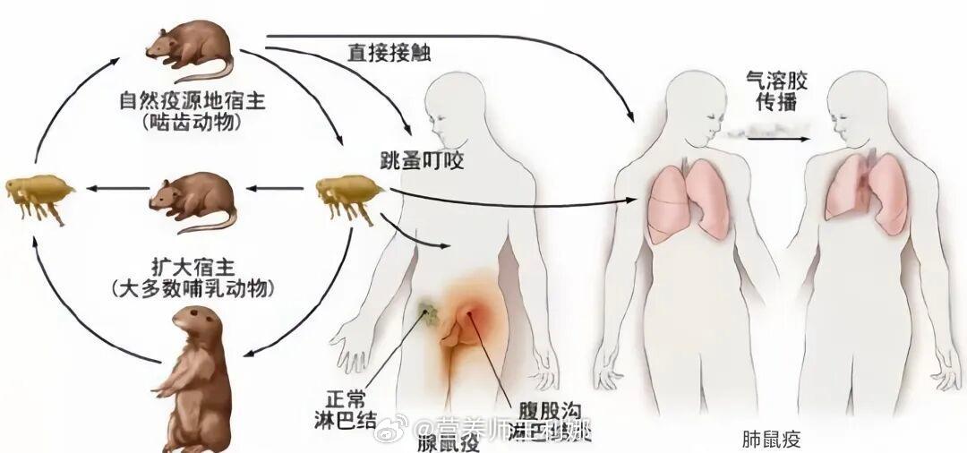 #内蒙古呼伦贝尔发布鼠疫风险提示##健闻登顶计划#鼠疫是由鼠疫耶尔森菌引起的甲类传染病，俗称“一号病