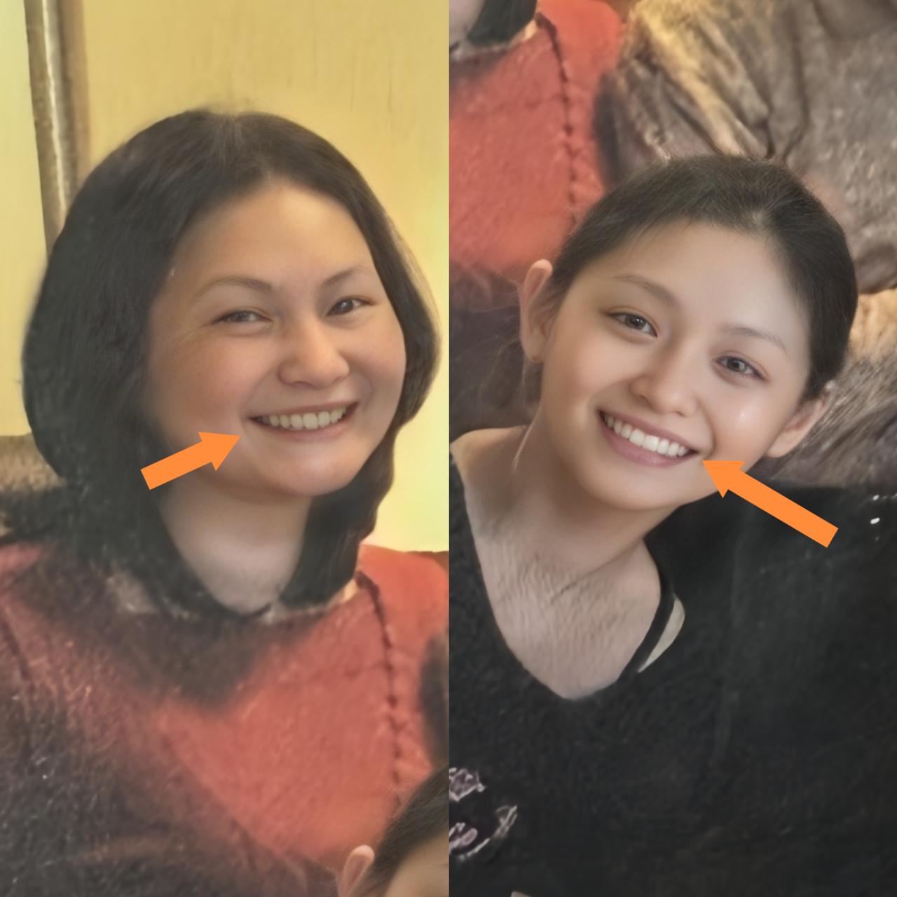 不得不说，大S天生就有一口整齐又洁白的牙齿，颜值优势十分突出，这份好牙口显然是遗