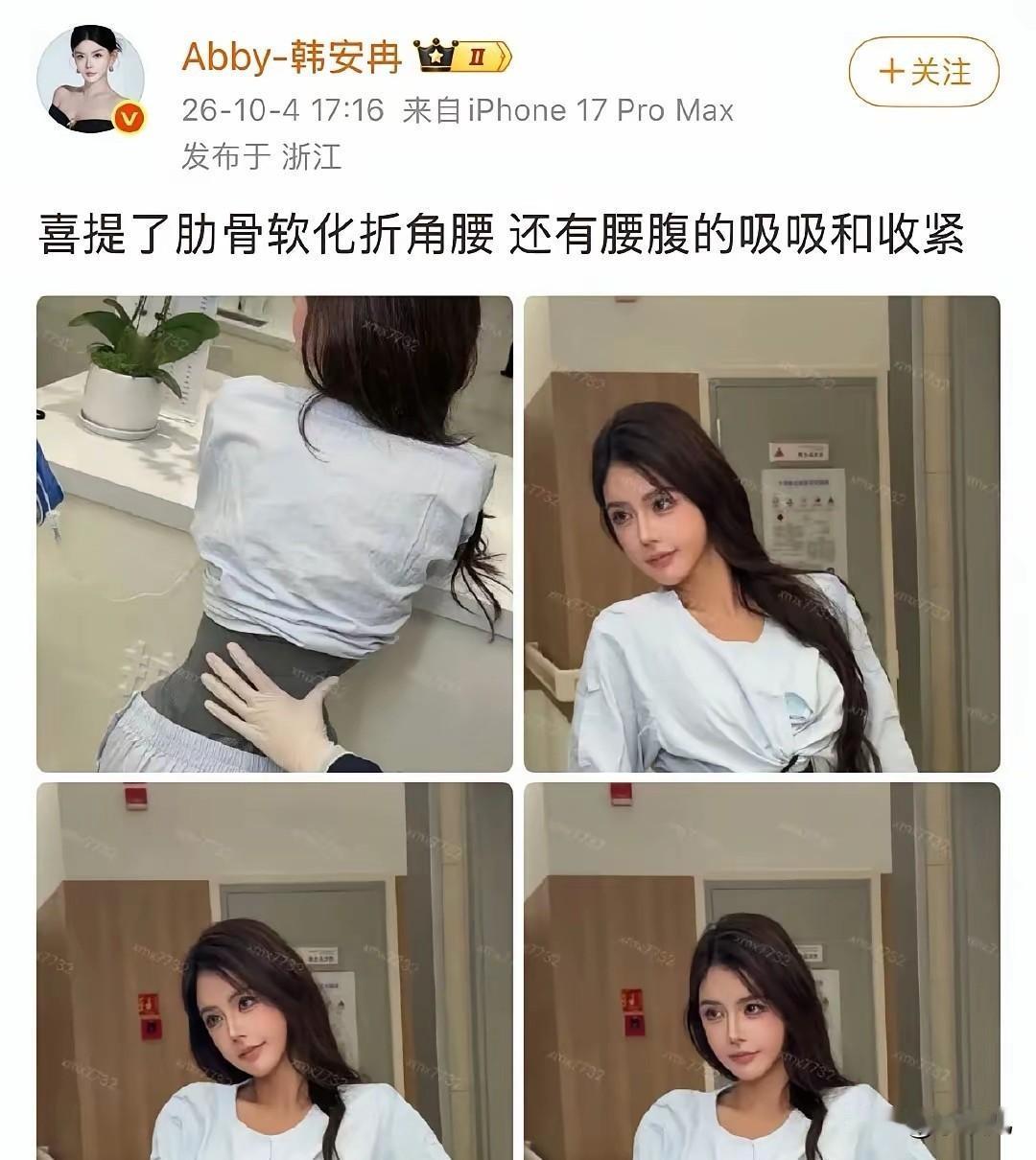 韩安冉又作妖了，她把肋骨软化了，做出这种折角腰，腰只有巴掌大，却连健康都不要了。