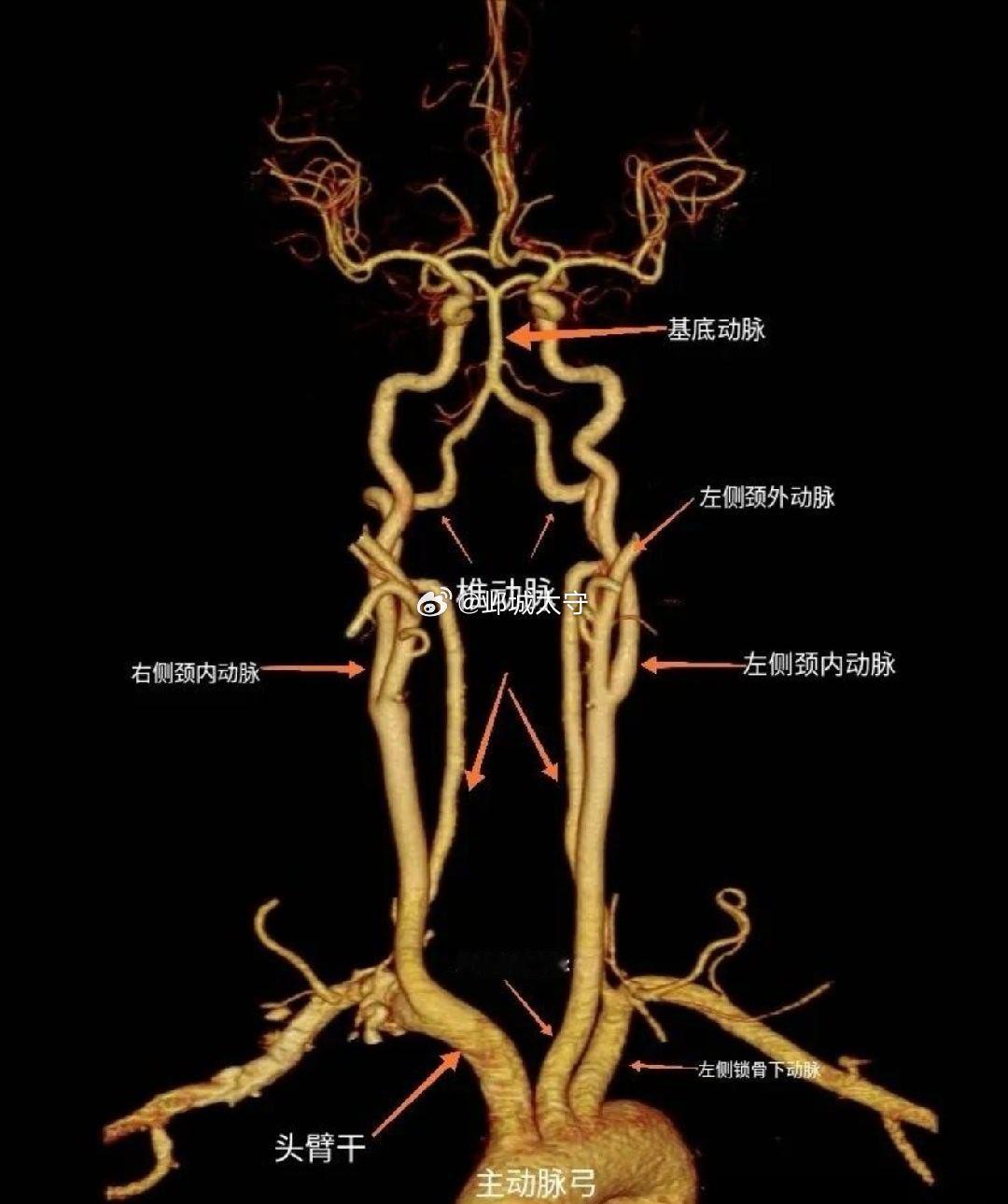 【36岁宝妈用筋膜枪按摩突发脑梗国医的精诚力量】这是一个非常典型且需要高度警