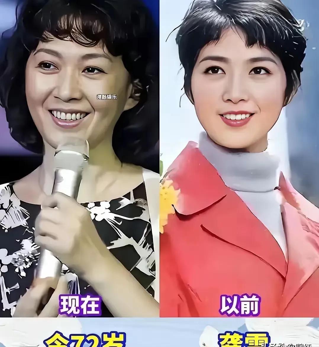 看到朱琳和巩俐的近照，我脑子里就蹦出四个字：降维打击。一个71岁，一个58岁。