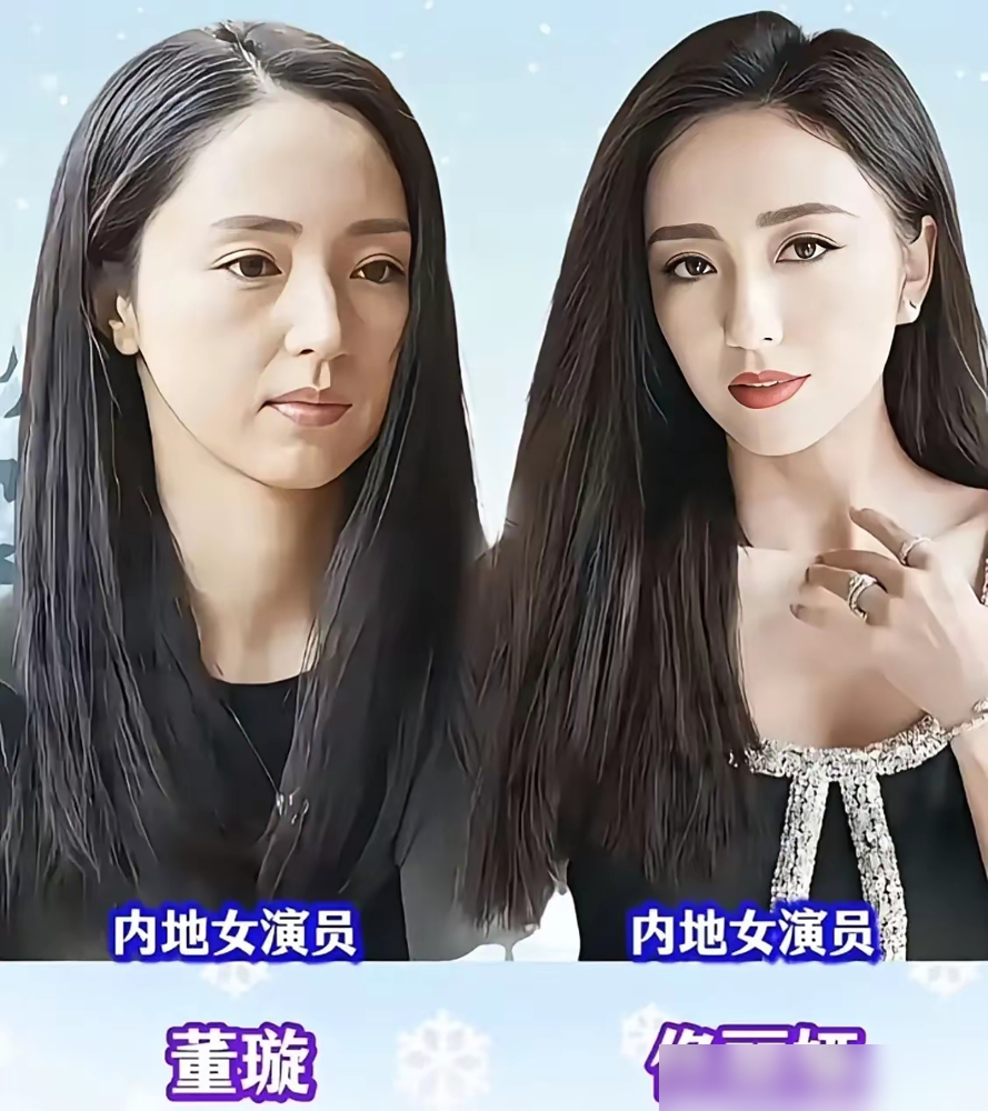 张子枫瘦到脱相，被说撞脸李维嘉，这事比你想的还扎心。佟丽娅董璇，白百何王珞丹，张一山夏雨，孙怡李沁。