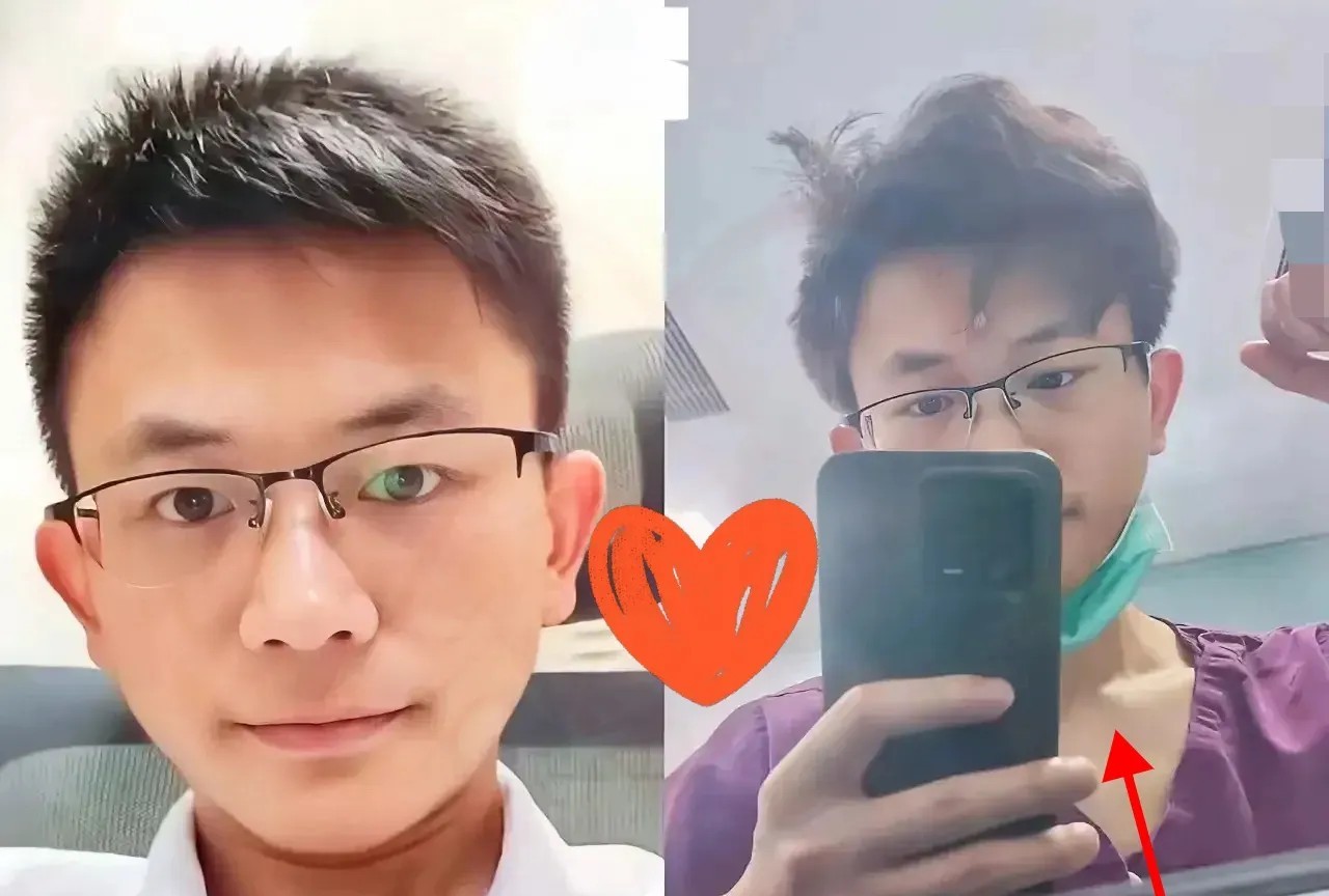 医生表哥偷偷告诉我：“罗帅宇还是太年轻了。”这事儿吧，没他想得那么简单。他可能不