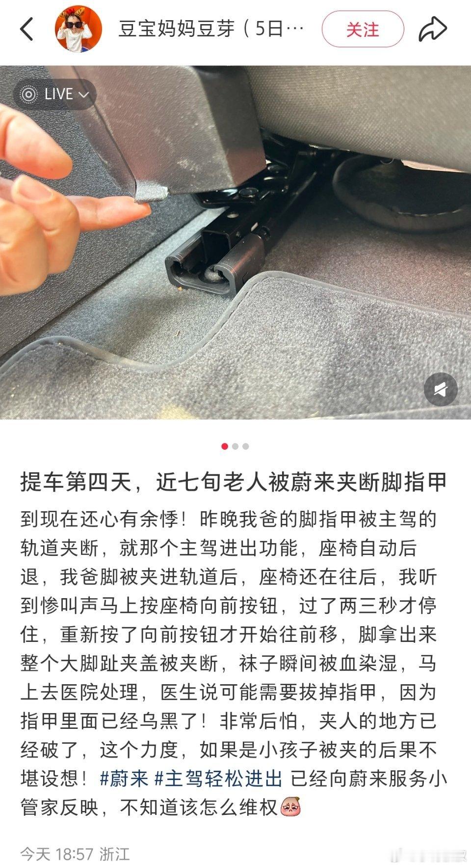 被电吸门夹的常见，被电动座椅轨道夹的第一次见…但看了下评论区，感觉这届网友不好带