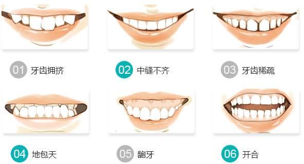 牙颌畸形是什么,牙颌畸形是什么原因,无牙畸形是什么症状