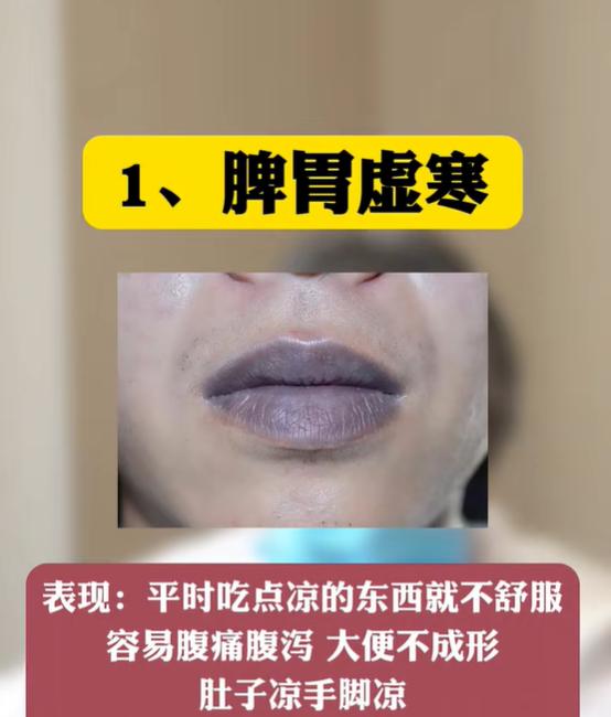 五种唇部状态对照表，分清各类脾胃问题